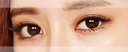 雙眼皮手術(shù)后怎么恢復(fù)比較快