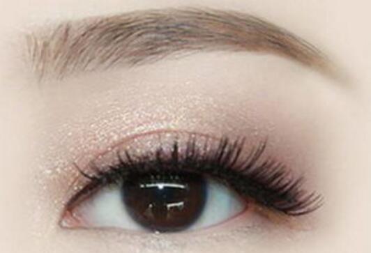 雙眼皮手術(shù)后怎么恢復(fù)比較快