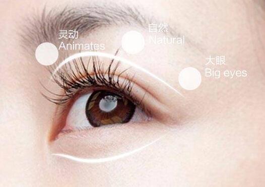 切開(kāi)雙眼皮手術(shù)后疤痕增生怎么辦