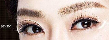 雙眼皮手術(shù)的價格受什么因素影響