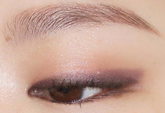 雙眼皮手術(shù)失敗會(huì)有什么癥狀