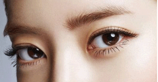 割雙眼皮會有什么風(fēng)險嗎