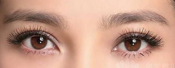 做雙眼皮手術(shù)會不會影響視力