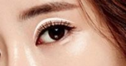 切開雙眼皮出血大不大