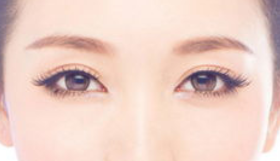 做埋線雙眼皮需要多少錢(qián)