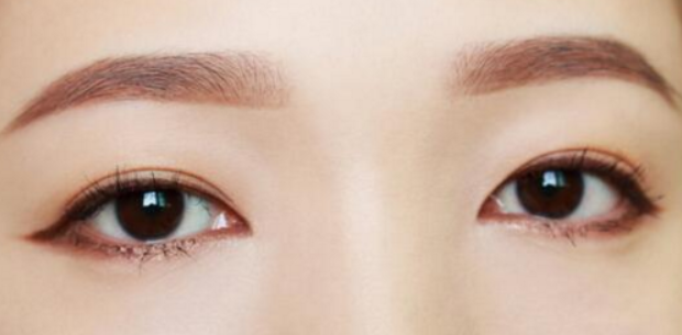 做雙眼皮手術(shù)會(huì)留疤嗎