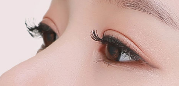 全切雙眼皮會有什么后遺癥問題嗎