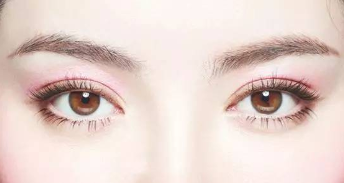 切開雙眼皮有哪些優(yōu)勢(shì)