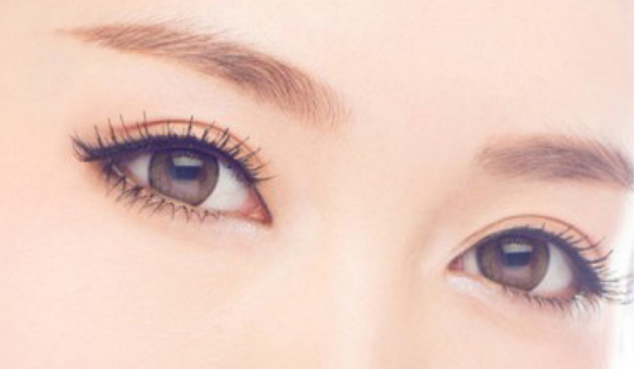 做雙眼皮手術(shù)后怎么消腫更快