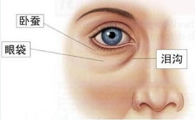 做眼袋手術多少錢