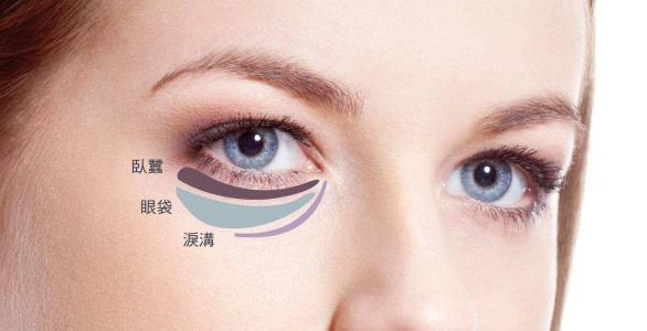 祛眼袋