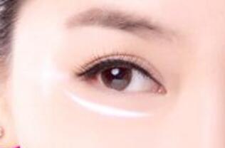 在廣州做祛眼袋手術要多少錢