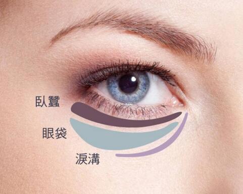 手術(shù)切除眼袋會(huì)有風(fēng)險(xiǎn)嗎