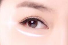 手術(shù)切除眼袋會(huì)有風(fēng)險(xiǎn)嗎