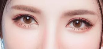 眼袋整形的價格貴不貴