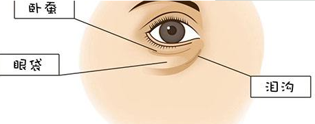 手術(shù)切除眼袋要多久恢復(fù)好