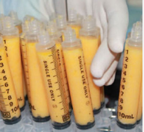 全臉脂肪填充多久恢復(fù)自然