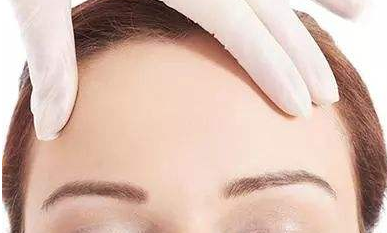 自體脂肪填充面部會(huì)有后遺癥風(fēng)險(xiǎn)嗎