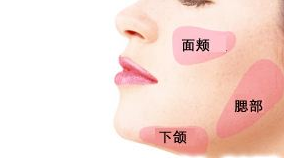 在廣州做面部脂肪填充的價(jià)格是多少