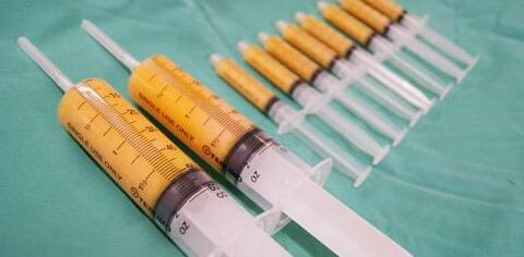 面部脂肪填充的價(jià)格是多少