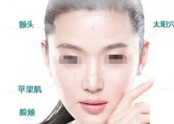 脂肪填充面部有硬塊怎么辦