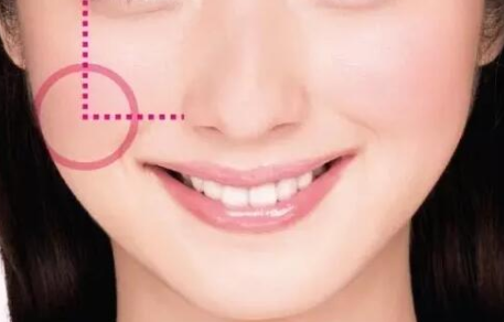 自體脂肪填充臉部多久恢復(fù)自然