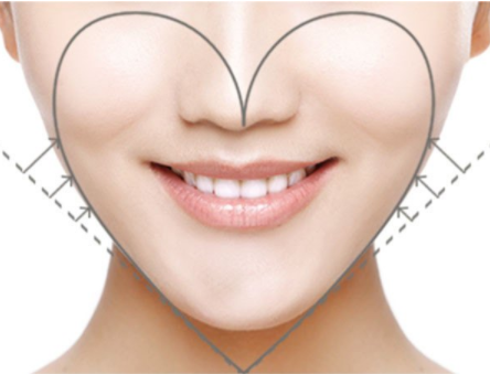 自體脂肪填充臉部術(shù)后要怎么護(hù)理