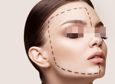 自體脂肪填充臉部會有風(fēng)險嗎