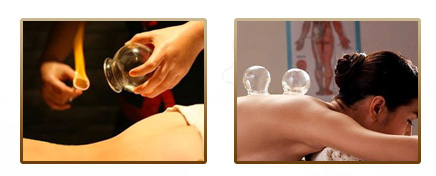 美萊中醫(yī)健康減肥方法-拔罐減肥效果