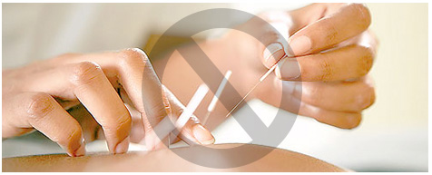 生活美容的美容院不能從事醫(yī)療美容活動(dòng)