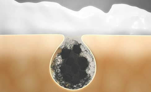 內(nèi)克斑--主守